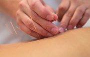 Acupuncture in the Treatment of Alzheimer’s