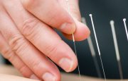 Acupuncture for Memory Loss May Help Prevent Dementia